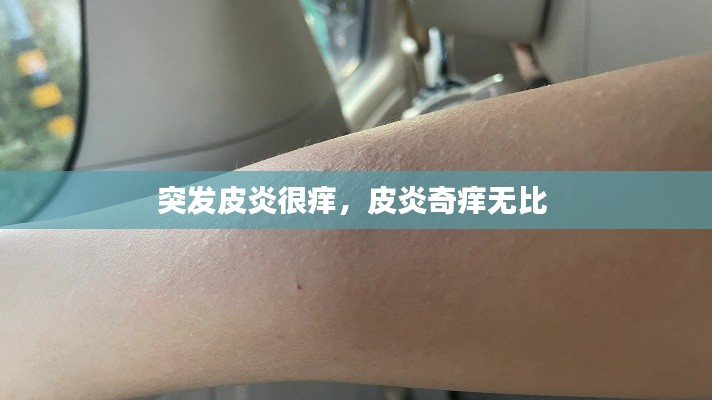 突发皮炎很痒,皮炎奇痒无比