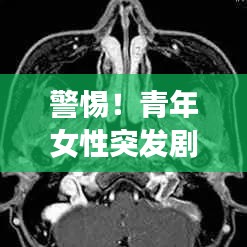警惕!青年女性突发剧烈头疼,身体紧急信号不容忽视