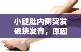 小腿肚内侧突发硬块发青,原因解析与应对策略